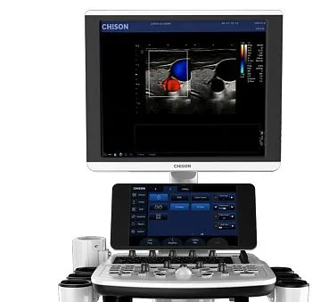 Ультразвуковой аппарат Chison Qbit 6
