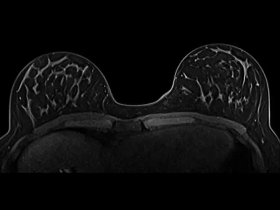 Клинические изображения Магнитно-резонансный томограф Siemens MAGNETOM Aera 1.5T