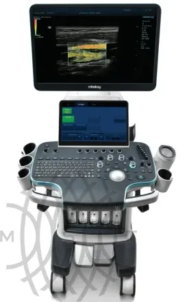 УЗИ аппарат Mindray Resona R9