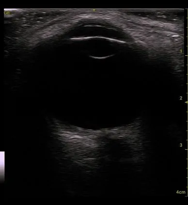 Клинические изображения GE Venue 50 аппарат УЗИ портативный