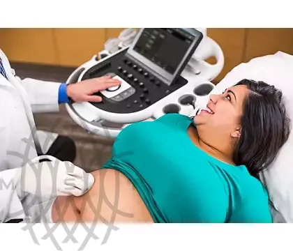 Philips Affiniti 70 ультразвуковой аппарат