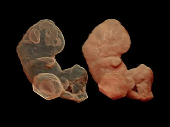 Клинические изображения Ультразвуковая диагностическая система GE Voluson E10