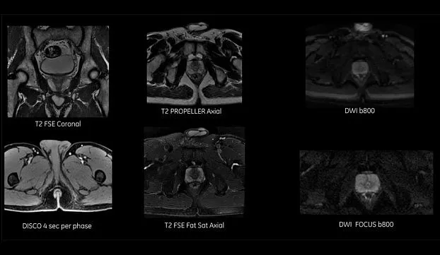 Клинические изображения МРТ аппарат GE SIGNA Voyager 1.5T