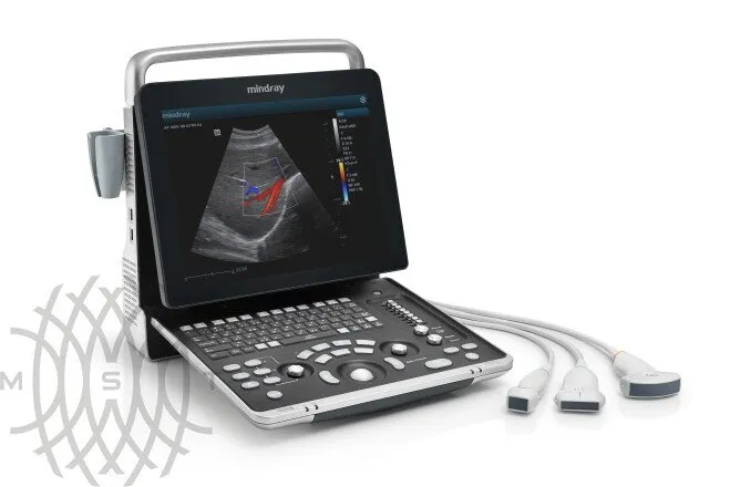 УЗИ аппарат Mindray Z60 портативный