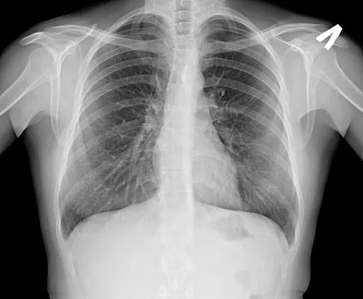 Клинические изображения Флюорограф цифровой С.П.Гелпик РЕНЕКС Ф-5000