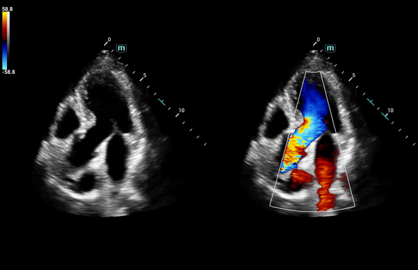 Клинические изображения УЗИ аппарат Mindray Consona N8