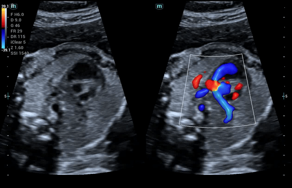 Клинические изображения УЗИ аппарат Mindray Consona N8
