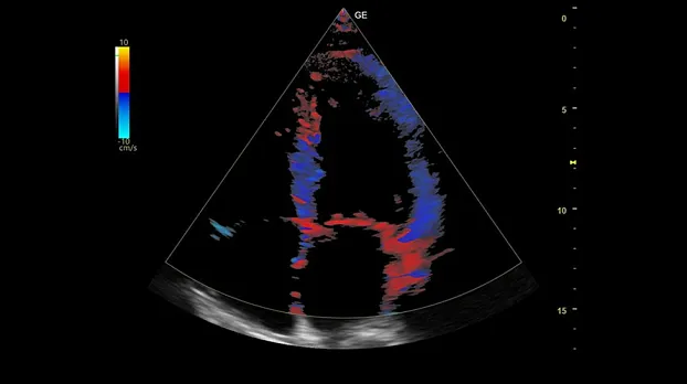 Клинические изображения GE HealthCare Versana Balance R2 УЗИ аппарат