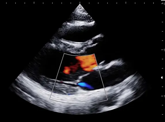 Клинические изображения УЗИ аппарат НПО СКАНЕР РУСКАН 65