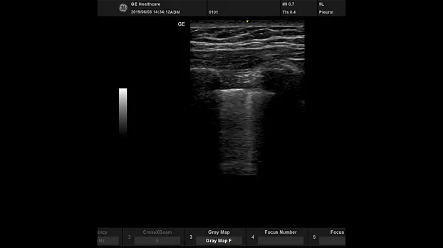 Клинические изображения УЗИ аппарат GE Healthcare Versana Active портативный