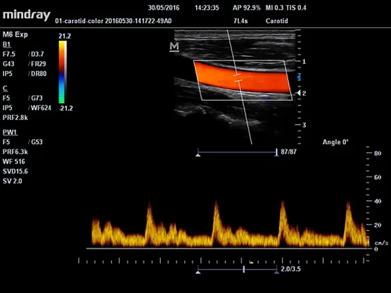 Клинические изображения Mindray M5 New Premium
