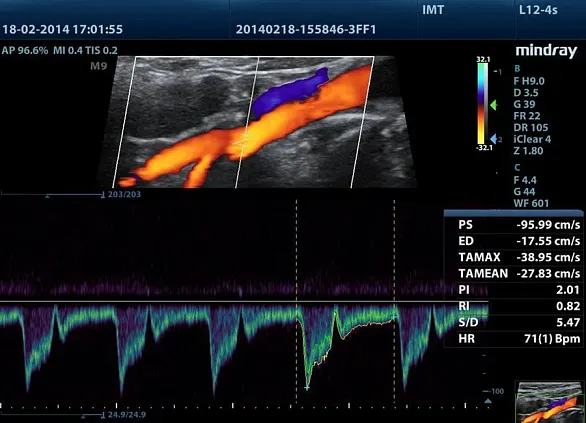 Клинические изображения УЗИ аппарат Mindray M8 портативный