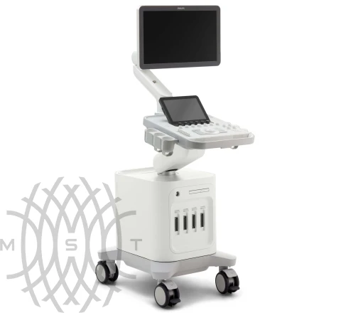 УЗИ аппарат Philips 3300