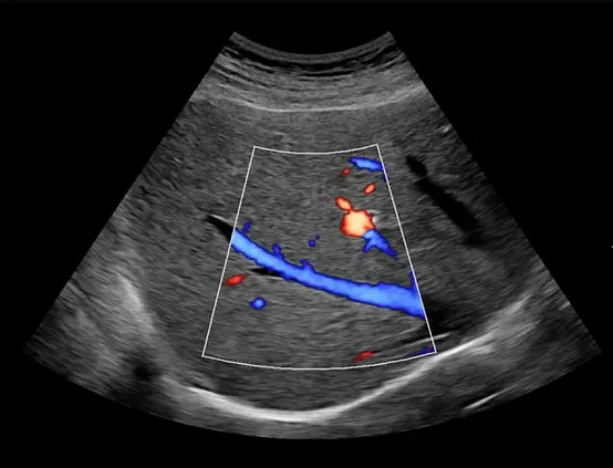 Клинические изображения УЗИ аппарат НПО СКАНЕР РУСКАН 65