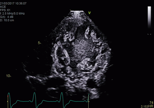 Клинические изображения УЗИ аппарат GE HealthCare Vivid E90