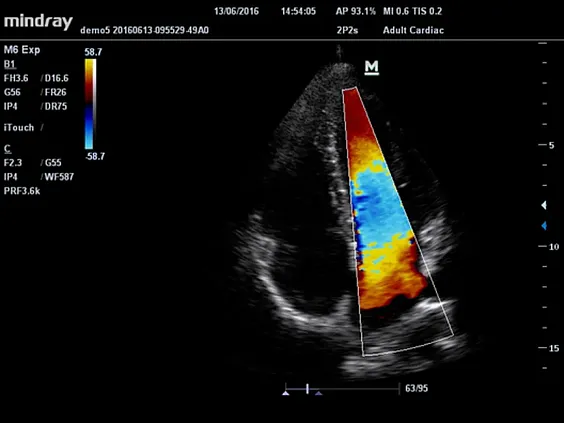 Клинические изображения Mindray M5 New Premium