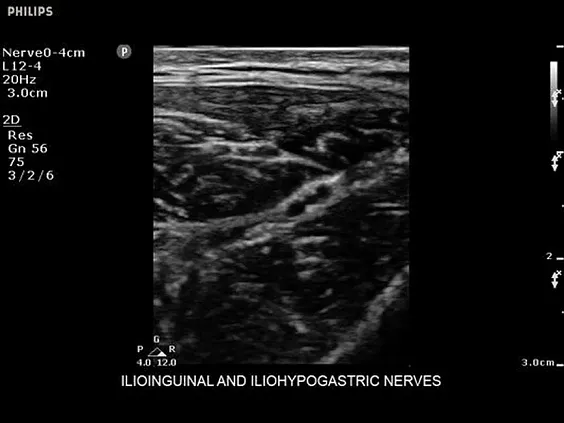 Клинические изображения Philips Sparq ультразвуковой аппарат