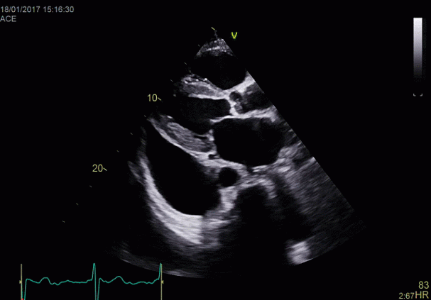 Клинические изображения Ультразвуковая диагностическая система GE HealthCare Vivid E95