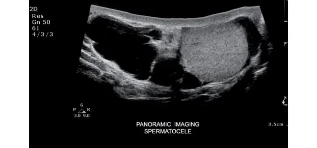 Клинические изображения Philips ClearVue 550 ультразвуковой аппарат