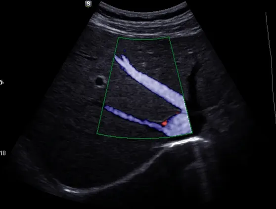 Клинические изображения УЗИ аппарат НПО СКАНЕР РУСКАН 70П портативный