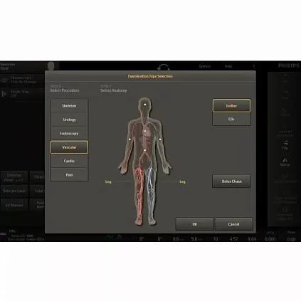 Клинические изображения Philips Veradius Unity С-дуга