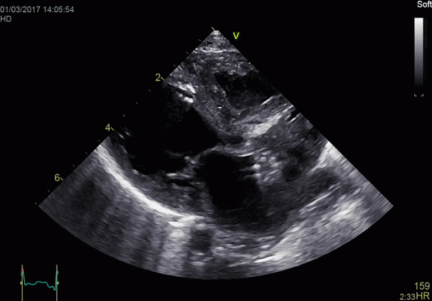 Клинические изображения УЗИ аппарат GE HealthCare Vivid E90